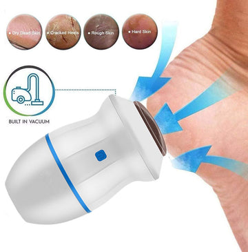 Electric Vacuum Foot Grinder File Machine: Exfoliate Dead Skin, Callus Remover, Heel Removal Scraper with Vacuum, Grinding Head for Heel.