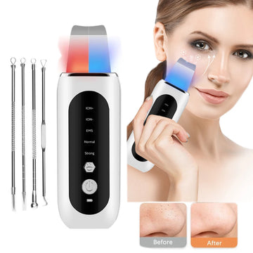 2024 Ultrasonic Skin Scrubber – Deep Cleansing Blackhead Remover, Facial Pore Cleaner & Ion Peeling Shovel