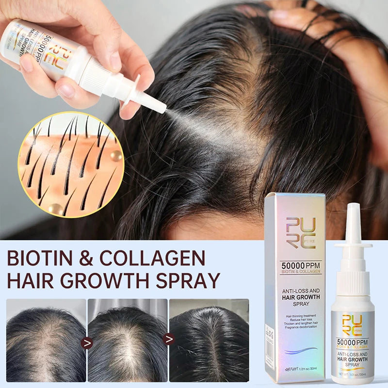       Biotin Hair Growth Products for Men and Women - Hair Loss Treatment, F – BEAUTY NET
