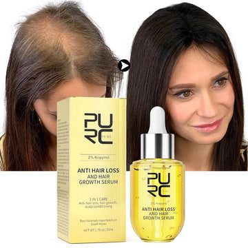 Excellent Hair Growth Oil for Men and Women / Anti-Hair Loss Scalp Treatment Serum