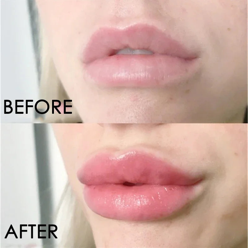       Instant Lip Enhancer Plumper Oil: Extreme Volumizing Lip Gloss Serum f – BEAUTY NET