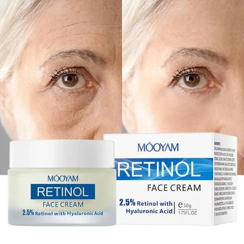       Retinol Face Cream: Anti-Aging, Wrinkle Whitening, Moisturizing, Impro – BEAUTY NET
