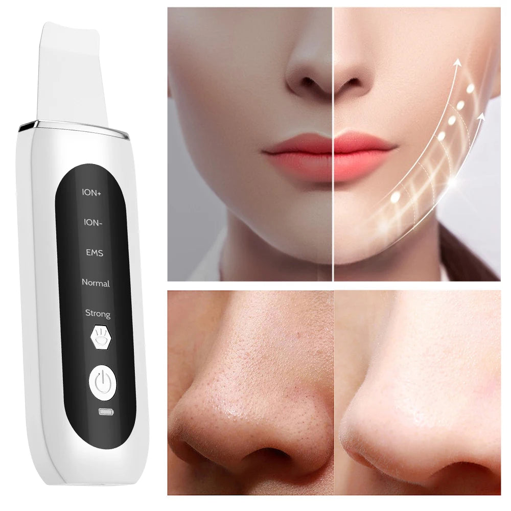 2024 Ultrasonic Skin Scrubber – Deep Cleansing Blackhead Remover, Facial Pore Cleaner & Ion Peeling Shovel