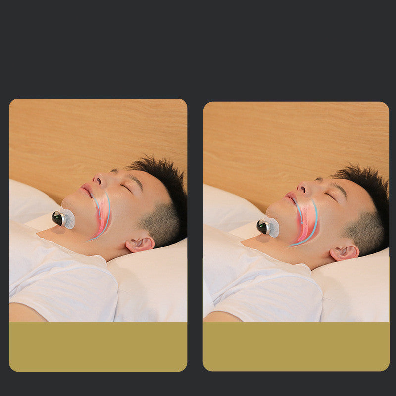 Third-Generation Intelligent Electric Anti-Snoring Device