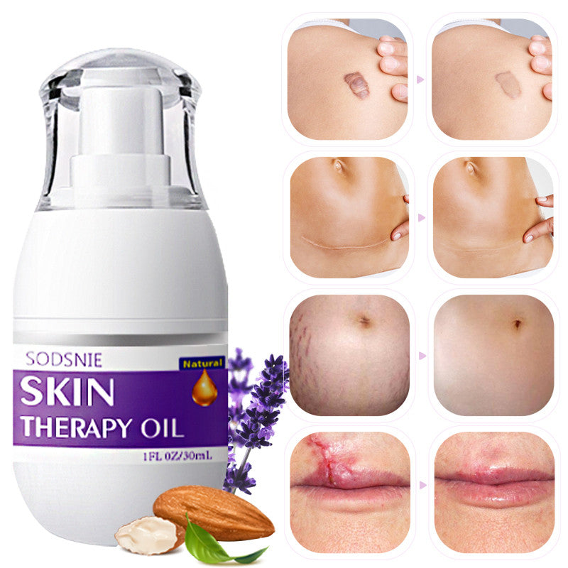 Skin Treatment Oil: Removes Puncture, Cellulite, and Stretch Marks. Repairs and Nourishes for Complete Body Care. 30ml.