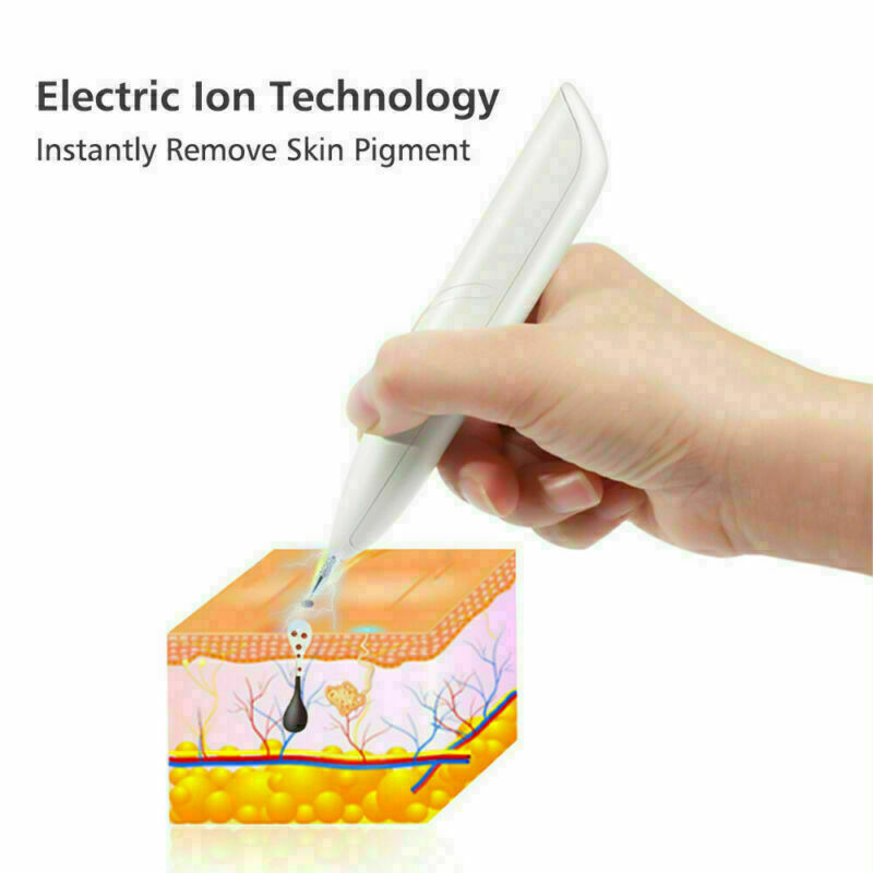 Ion Laser Freckle, Skin Mole, Dark Spot Remover Face Wart Tag Tattoo Removal Pen.