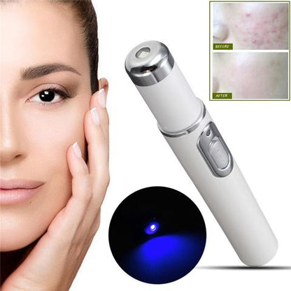 Blue Light Therapy Acne Laser Pen: Softens Scars and Reduces Wrinkles. Remove Treatments for Skin Care and Beauty Equipment.