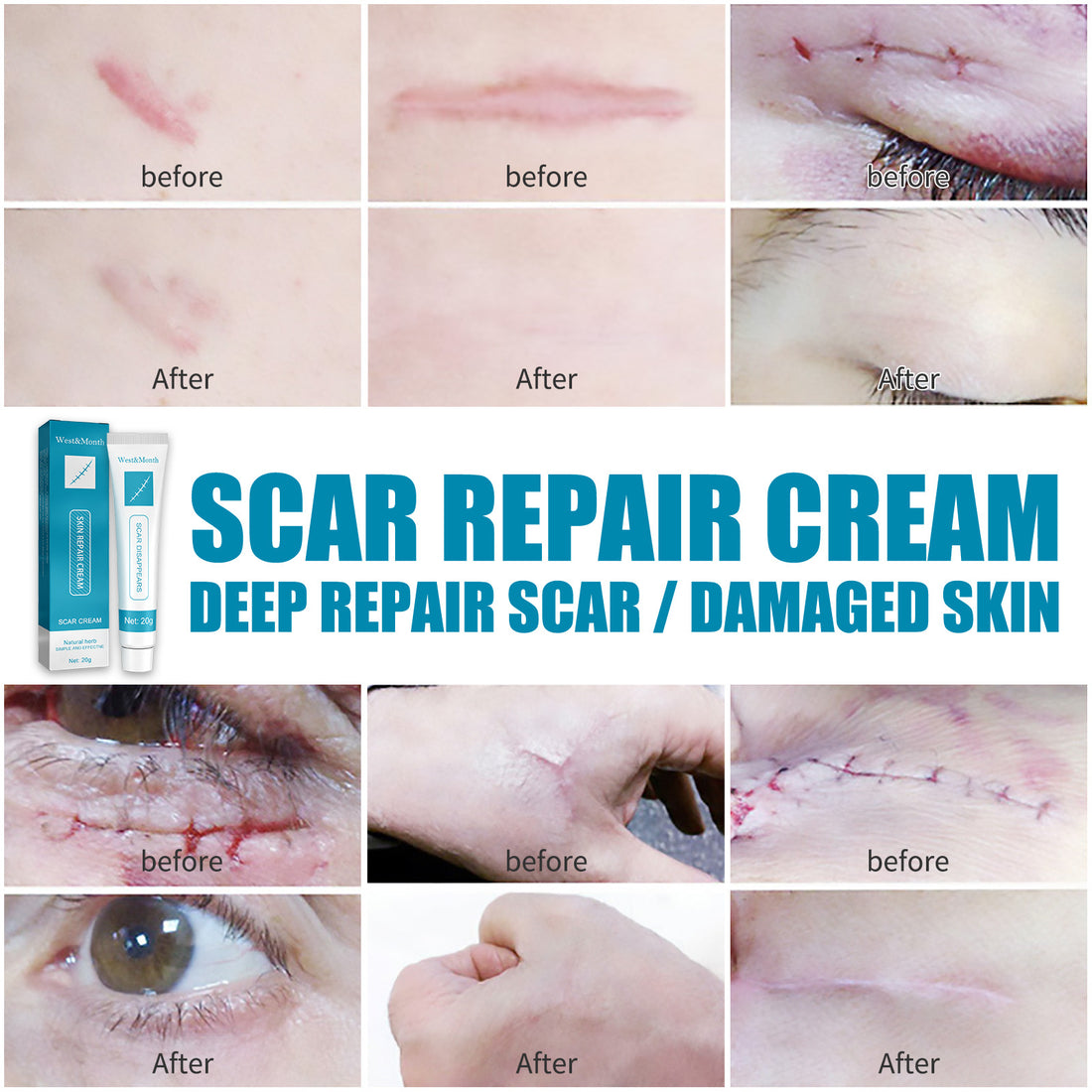 Smooth Skin Scar Repair Cream