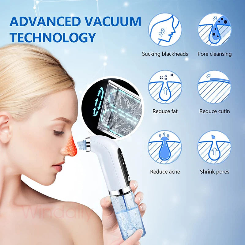 Blackhead Remover / Pore Vacuum Cleaner / Electric Micro Small Bubble Facial Cleansing Machine - USB Rechargeable Beauty Device.