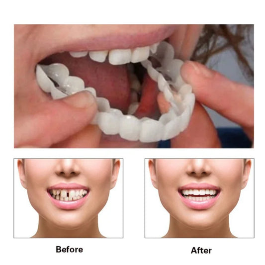 Fake Tooth Cover - Perfect Fit Teeth Whitening Snap-On Silicone Smile Veneers. Dentaduras Flexibles, a Beauty Tool for Cosmetic Use.