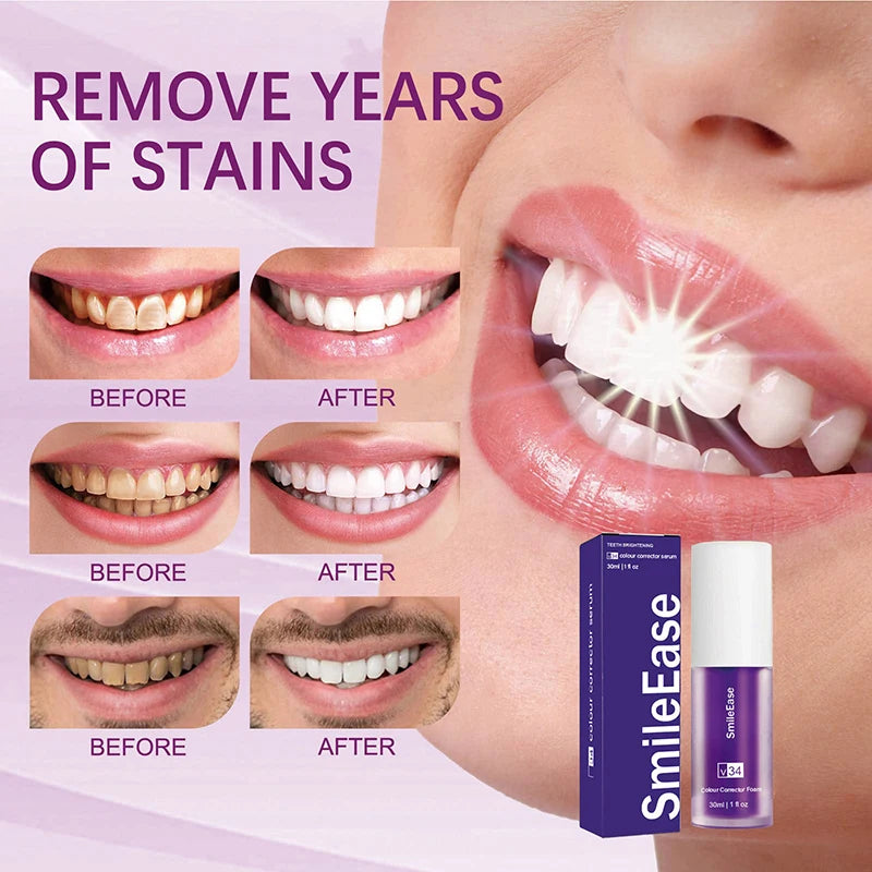 V34 Purple Whitening Toothpaste: Cleans Mouth, Freshens Breath, Removes Yellow Stains, Protects Teeth, Whitens, and Provides Decontamination Care - 2024