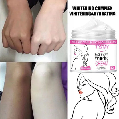 Body Whitening Cream for Underarm, Armpit, Knee: Dark Skin Whitening Bleaching Cream, Moisturizing, Brightening Body Lotion for Women and Men