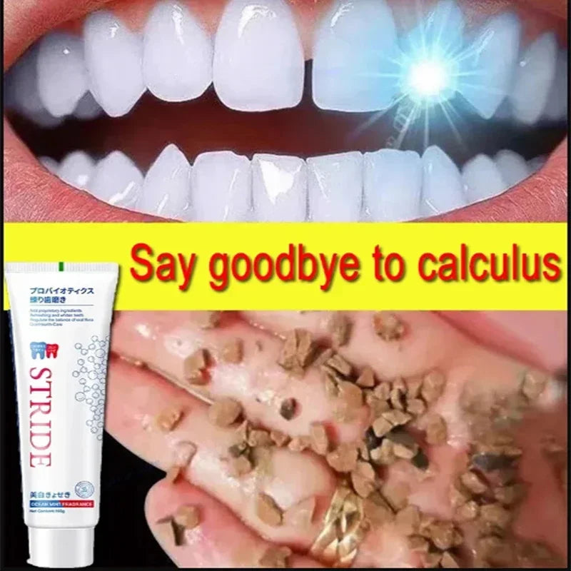 Dental Calculus Remover: Bad Breath Removal, Whitening Teeth Toothpaste, Brightening, Preventing Periodontitis, Dental Cleansing Care