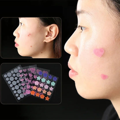 Pimple Patch - Colorful Invisible Acne Removal Skin Care Stickers, Original Concealer, Face Spot Beauty Makeup Tool