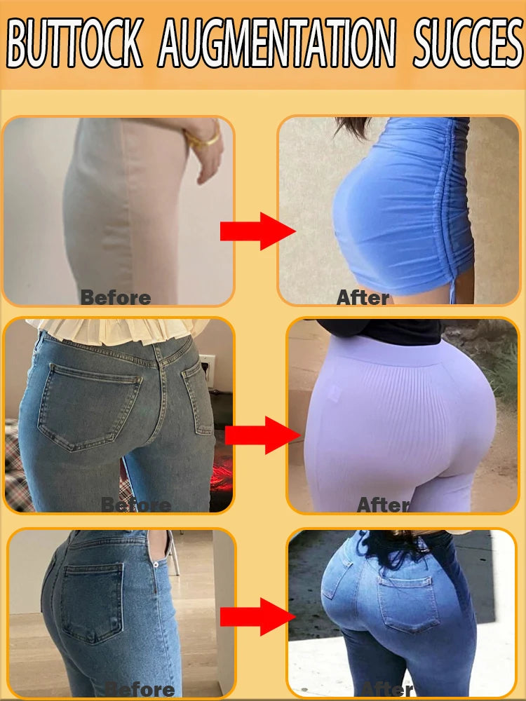 Buttock Augmentation Oil for Natural Buttock Enlargement – Unlock Your Curves