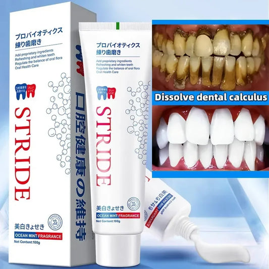 Dental Calculus Remover: Bad Breath Removal, Whitening Teeth Toothpaste, Brightening, Preventing Periodontitis, Dental Cleansing Care