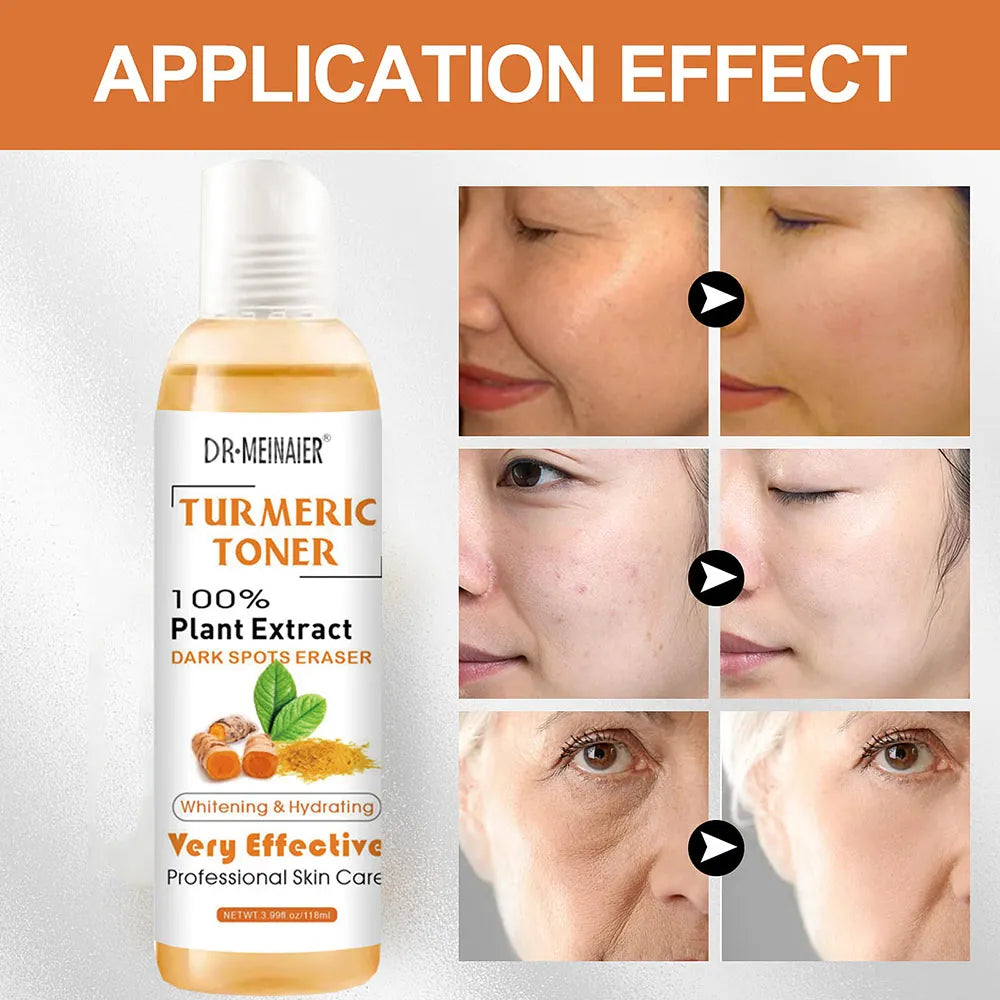 Set of 2 Turmeric Dark Spot Toners – Erase, Correct, and Fade Blemishes for Dark Skin. A powerful solution for dark spots, blemishes, and acne removal.