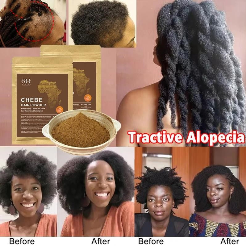 African Hair Growth Chebe Powder: Fast Hair Loss Treatment